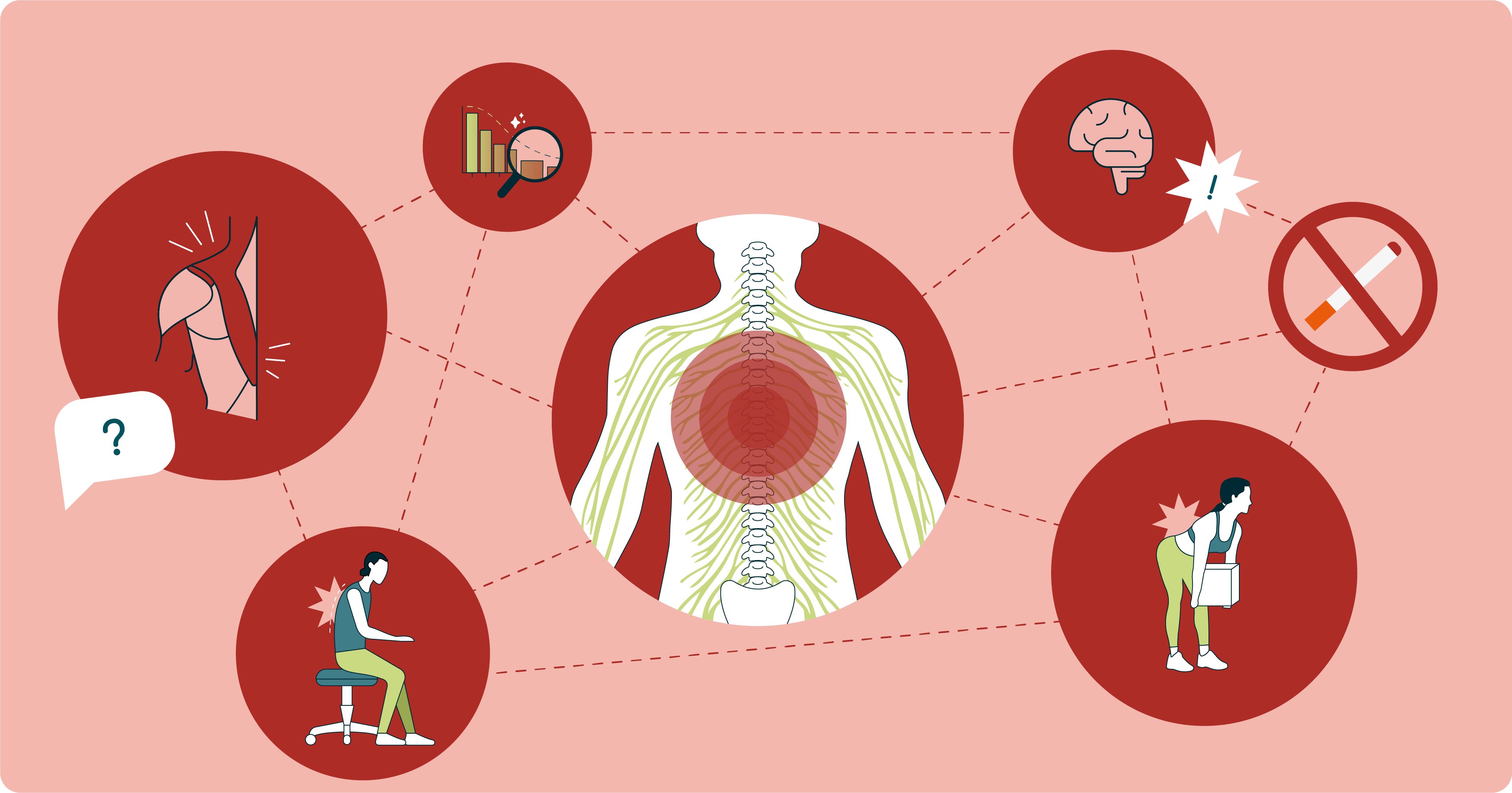 Illustration of a painful lower back with 6 causes dotted around