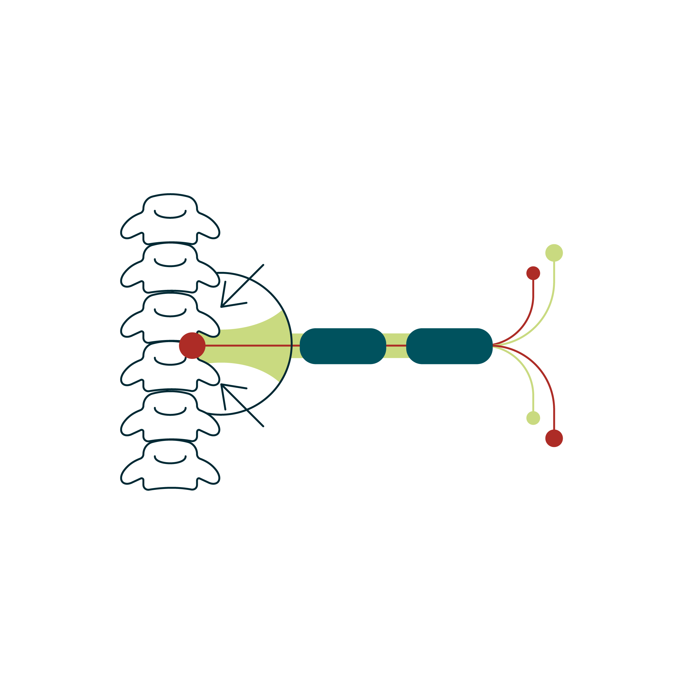 Illustration showing close up of nerve between spine joints